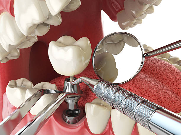 Best Root Canal Emergency Dentist  in Northbrook, OH